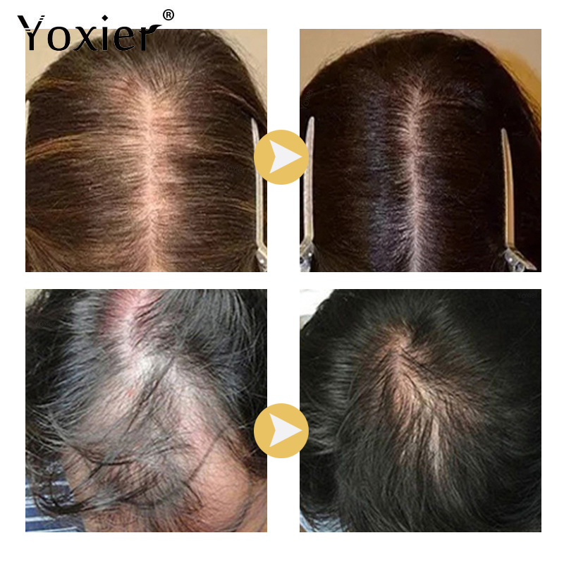 Suero de crecimiento intensivo - Hair Care Treatment reseña y precio