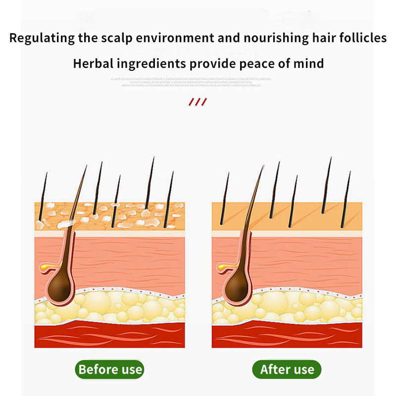 Sophora Flavescens crema para  - Hair Care Cream reseña y precio